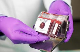 ذخیره سازی بیش از ۶ هزار نمونه خون بند ناف در آذربایجان شرقی